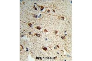 Formalin-fixed and paraffin-embedded human brain tissue reacted with FMOD Antibody (C-term), which was peroxidase-conjugated to the secondary antibody, followed by DAB staining. (Fibromodulin antibody  (C-Term))