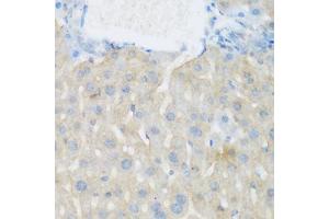 Immunohistochemistry of paraffin-embedded mouse liver using EGFR antibody (ABIN5997650) at dilution of 1/100 (40x lens). (EGFR antibody)