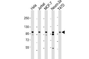 Western Blotting (WB) image for anti-Enhancer of Zeste Homolog 2 (EZH2) (AA 1-296), (N-Term) antibody (ABIN650707)