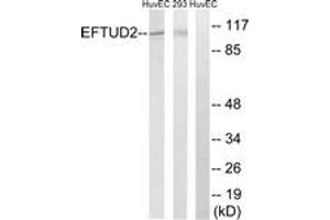 Western blot analysis of extracts from 293/HuvEc cells, using EFTUD2 Antibody. (EFTUD2 antibody  (AA 321-370))
