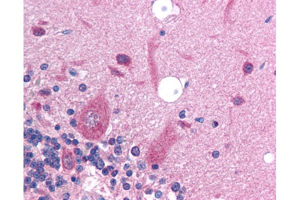 SLC17A2 antibody  (AA 230-279)