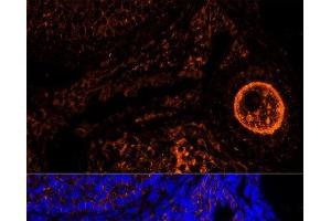 Immunofluorescence analysis of Mouse oophoroma cells using ZP2 Polyclonal Antibody at dilution of 1:100.