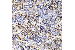 Immunohistochemistry of paraffin-embedded rat spleen using UBASH3B antibody at dilution of 1:100 (x400 lens). (UBASH3B antibody)