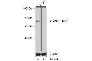 Western blot analysis of extracts of MCF7 cell line using Phospho-CHEK1(S317) Polyclonal Antibody.