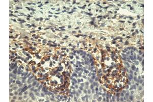 Immunohistochemistry staining of tonsil (paraffin-embedded sections) with anti-human Tenascin (T2H5).
