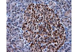 Immunohistochemical staining of paraffin-embedded colon tissue using anti-MCL1 mouse monoclonal antibody. (MCL-1 antibody)