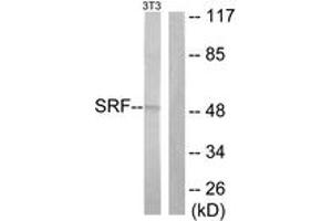 Western blot analysis of extracts from NIH-3T3 cells, treated with PMA 125ng/ml 30', using SRF (Ab-99) Antibody. (SRF antibody  (AA 71-120))