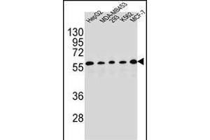 X1 Antibody (C-term) (ABIN654415 and ABIN2844152) western blot analysis in HepG2,MDA-M,293,K562,MCF-7 cell line lysates (35 μg/lane).