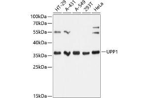 Western blot analysis of extracts of various cell lines, using UPP1 Antibody (ABIN6128903, ABIN6149952, ABIN6149953 and ABIN6216895) at 1:3000 dilution. (UPP1 antibody  (AA 89-173))
