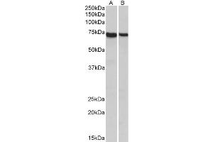 ABIN2613455 (1µg/ml) staining of Mouse (A) and Rat (B) Spleen lysates (35µg protein in RIPA buffer). (STXBP3 antibody  (Internal Region))