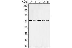 Western blot analysis of Cytokeratin 10 expression in HeLa (A), A431 (B), Raw264. (Keratin 10 antibody  (Center))