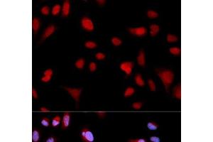 Immunofluorescence analysis of MCF-7 cells using Phospho-ABL1(Y204) Polyclonal Antibody (ABL1 antibody  (pTyr204))