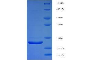 SDS-PAGE (SDS) image for Fibroblast Growth Factor 21 (FGF21) (AA 29-210) protein (His tag) (ABIN5709521)