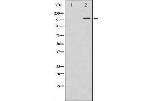 Western blot analysis of VEGFR2 phosphorylation expression in Na3VO4 treated HepG2 whole cell lysates,The lane on the left is treated with the antigen-specific peptide. (VEGFR2/CD309 antibody  (pTyr1059))