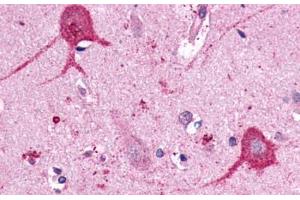 Anti-OPN3 / Encephalopsin antibody  ABIN1049165 IHC staining of human brain, neurons and glia. (OPN3 antibody  (C-Term))