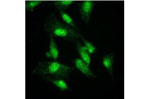 Immunofluorescence (IF) image for anti-K(lysine) Acetyltransferase 2A (KAT2A) (AA 411-837) antibody (ABIN487349) (KAT2A antibody  (AA 411-837))
