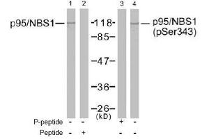 Image no. 2 for anti-Nibrin (NBN) (Ser343) antibody (ABIN197201) (Nibrin antibody  (Ser343))