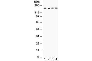 Western blot testing of human 1) 293, 2) SW620, 3) COLO320 and 4) HeLa cell lysate with HKDC1 antibody. (HKDC1 antibody)