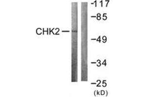 Western blot analysis of extracts from COS7 cells treated with UV 30', using Chk2 (Ab-383) Antibody. (CHEK2 antibody  (AA 356-405))