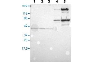 Western blot analysis of Lane 1: RT-4, Lane 2: U-251 MG, Lane 3: A-431, Lane 4: Liver, Lane 5: Tonsil with A2M polyclonal antibody (PAB28545). (alpha 2 Macroglobulin antibody)