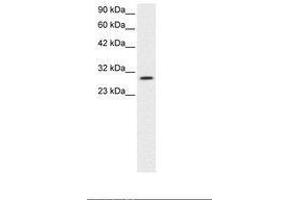 Image no. 3 for anti-Jumonji Domain Containing 8 (JMJD8) (AA 111-160) antibody (ABIN6735793) (JMJD8 antibody  (AA 111-160))