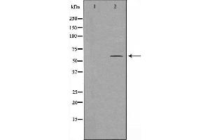 Western blot analysis of extracts from HeLa cells, using HARS antibody. (HARS1/Jo-1 antibody  (C-Term))