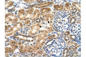 GCNT3 antibody was used for immunohistochemistry at a concentration of 4-8 ug/ml to stain EpitheliaI cells of renal tubule (arrows) in Human Kidney. (GCNT3 antibody)