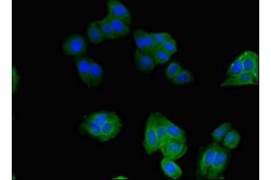 Immunofluorescent analysis of HepG2 cells using ABIN7170364 at dilution of 1:100 and Alexa Fluor 488-congugated AffiniPure Goat Anti-Rabbit IgG(H+L) (SNX17 antibody  (AA 280-457))