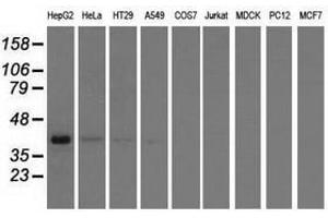 Image no. 3 for anti-3-hydroxyisobutyryl-CoA Hydrolase (HIBCH) antibody (ABIN1498655) (HIBCH antibody)