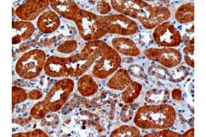 USH1C polyclonal antibody  (10 ug/mL) staining of paraffin embedded human kidney.