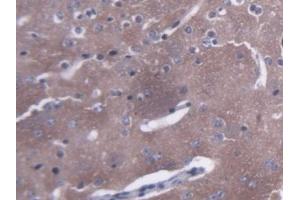 Detection of AMPH in Mouse Cerebrum Tissue using Polyclonal Antibody to Amphiphysin (AMPH) (Amphiphysin antibody  (AA 24-240))