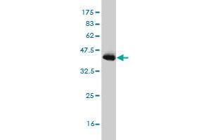 Western Blot detection against Immunogen (36. (PIAS3 antibody  (AA 453-550))