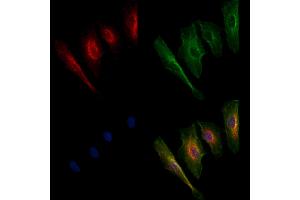 ABIN6259871 and ABIN6269218 staining  cells by IF/ICC.