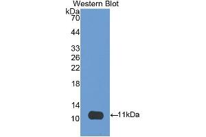 Western Blotting (WB) image for anti-CD3d Molecule, delta (CD3-TCR Complex) (CD3D) (AA 19-99) antibody (ABIN3205927) (CD3D antibody  (AA 19-99))