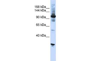 WB Suggested Anti-DIS3 Antibody Titration:  0. (DIS3 antibody  (N-Term))