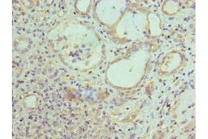 Immunohistochemistry of paraffin-embedded human kidney tissue using ABIN7157845 at dilution of 1:100 (EPM2A antibody  (AA 244-331))