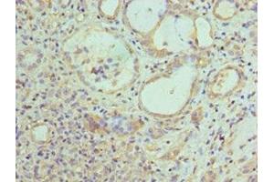 Immunohistochemistry (IHC) image for anti-Epilepsy, Progressive Myoclonus Type 2A, Lafora Disease (Laforin) (EPM2A) (AA 244-331) antibody (ABIN7157845)