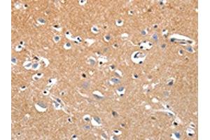 The image on the left is immunohistochemistry of paraffin-embedded Human brain tissue using ABIN7191320(LRP3 Antibody) at dilution 1/80, on the right is treated with synthetic peptide. (LRP3 antibody)