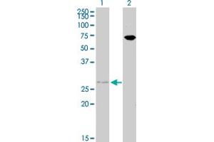 Western Blot analysis of HOXB7 expression in transfected 293T cell line by HOXB7 monoclonal antibody (M02), clone 4A3.