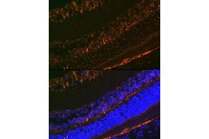 Immunofluorescence (IF) image for anti-Retinaldehyde Binding Protein 1 (RLBP1) antibody (ABIN7269934)
