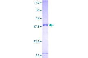 ULK3 Protein (AA 1-214) (GST tag)