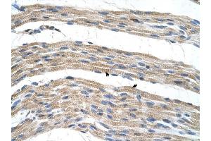 SLC17A4 antibody was used for immunohistochemistry at a concentration of 4-8 ug/ml to stain Skeletal muscle cells (arrows) in Human Muscle. (SLC17A4 antibody)