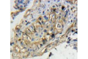 Used in DAB staining on fromalin fixed paraffin-embedded Ovary tissue (TPBG antibody  (AA 34-356))