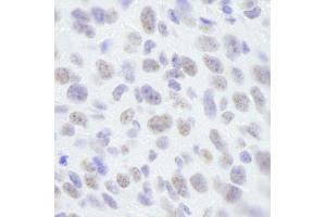 Immunohistochemistry (IHC) image for anti-Scaffold Attachment Factor B (SAFB) (C-Term) antibody (ABIN7448784) (SAFB antibody  (C-Term))
