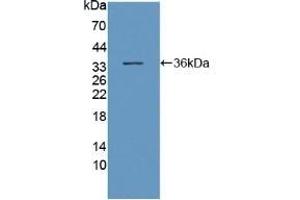 Detection of Recombinant DNAH11, Human using Polyclonal Antibody to Dynein, Axonemal, Heavy Chain 11 (DNAH11) (DNAH11 antibody  (AA 17-299))