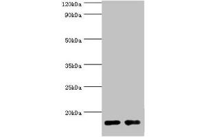 Western blot All lanes: Gastrotropin antibody at 8 μg/mL Lane 1: Mouse small intestine tissue Lane 2: Rat small intestine tissue Secondary Goat polyclonal to rabbit IgG at 1/10000 dilution Predicted band size: 15, 20 kDa Observed band size: 15 kDa (FABP6 antibody  (AA 1-128))