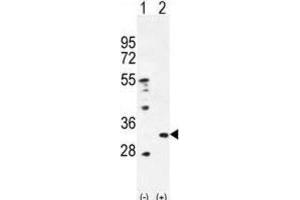 Western Blotting (WB) image for anti-Peroxiredoxin 4 (PRDX4) antibody (ABIN2996535) (Peroxiredoxin 4 antibody)