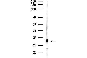 Western blot analysis of lysates from MCF7 cells(heat-shock,45 min treatment), using NDUFAF2 Antibody at 1/1000 dilution.