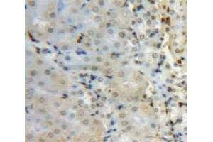 #VALUE! (SUV420H2/KMT5C antibody  (AA 2-279))