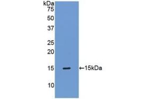 Detection of Recombinant TIMP1, Mouse using Polyclonal Antibody to Tissue Inhibitors Of Metalloproteinase 1 (TIMP1) (TIMP1 antibody  (AA 35-160))